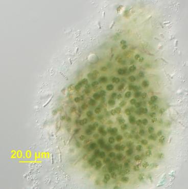 Microscopic view of a small colony of cyanobacteria.